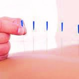 Needle therapy image