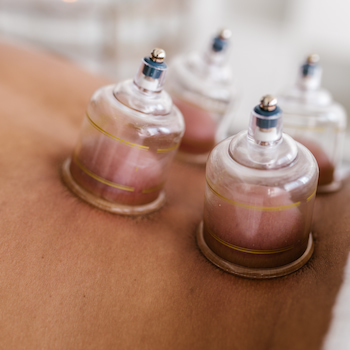 Cupping image